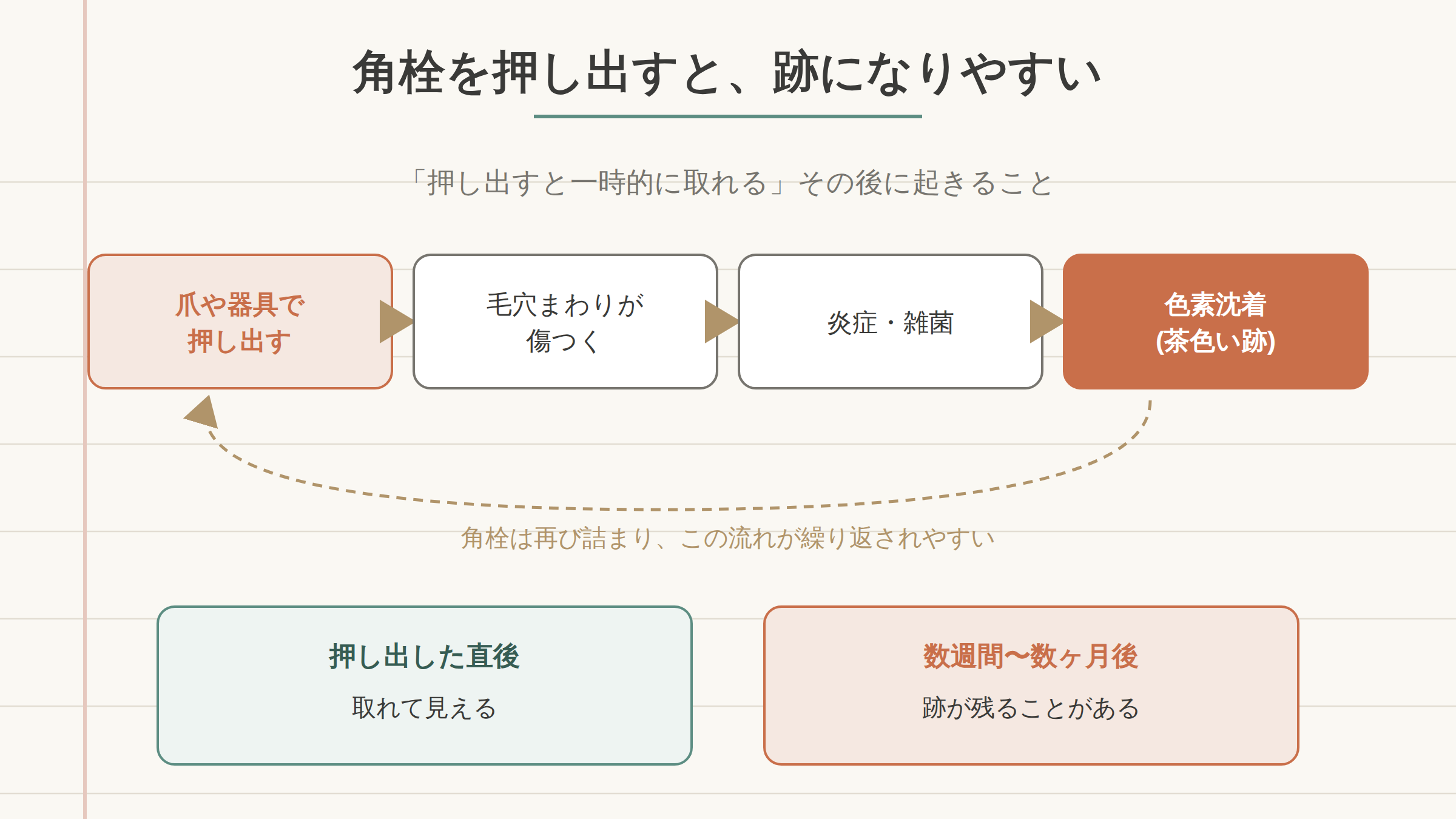 角栓を押し出すと傷・炎症を経て色素沈着に至る経路を示す図解