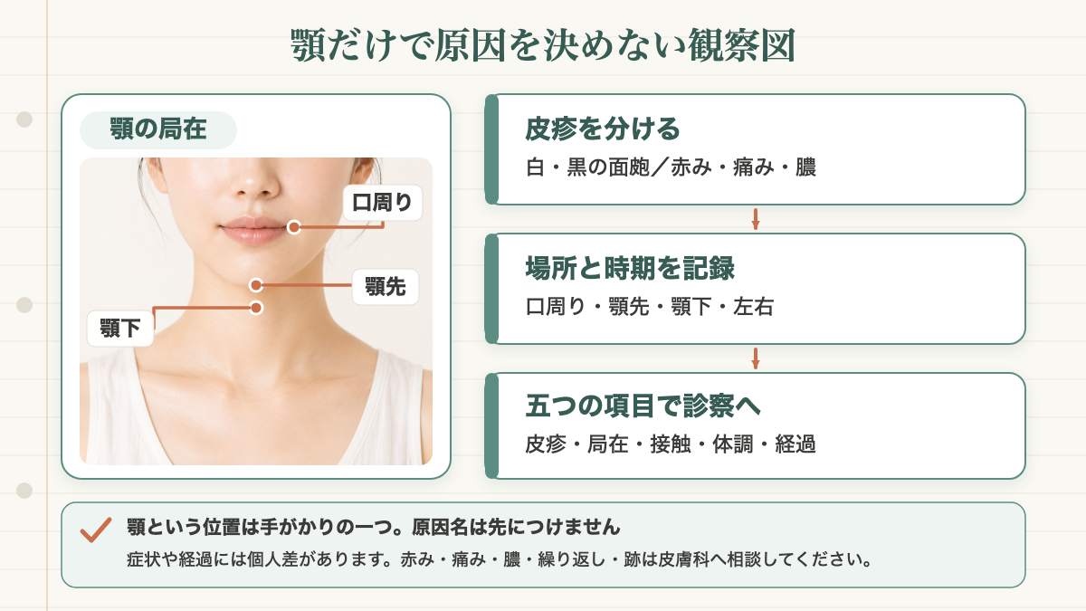 顎ニキビを顎という位置だけで単一原因にせず、毛穴内の面皰や炎症、口周り・顎先・顎下の局在、マスクや手などの接触と体調の変化を分け、皮疹・局在・接触・体調・経過の五つの項目を皮膚科へ渡す関係図