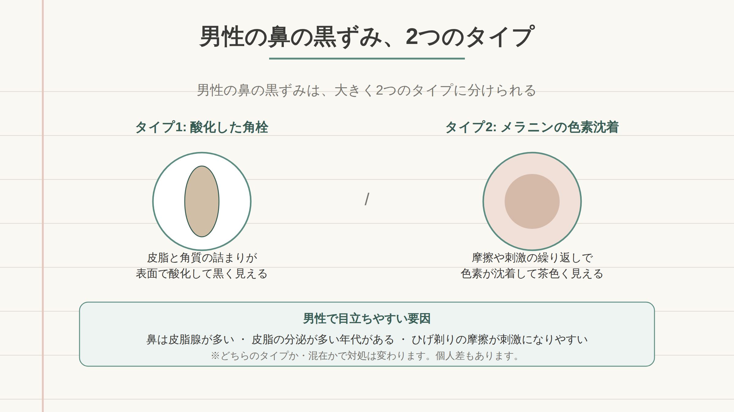 男性の鼻の黒ずみを酸化した角栓とメラニンの色素沈着の2タイプに分け、男性で目立ちやすい要因(鼻の皮脂腺の多さ・皮脂ピークの年代差・髭剃りの摩擦)を整理した図。